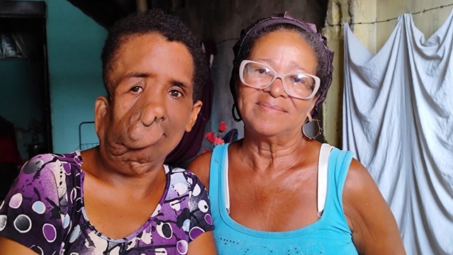 Mãe pede ajuda para comprar materiais para vender pipoca após filha sofrer AVC ft ney silva acorda cidade2