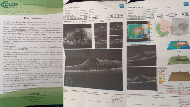 O idoso apresentou em relatório médico e exames para comprovar a problema na visão