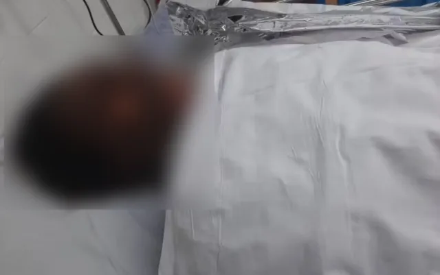 homem atei fogo queimadura mulher salvador