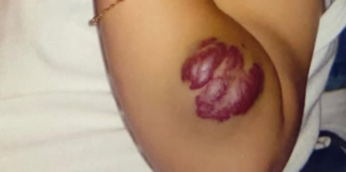 Duda Guerra: Ex-nora de Angélica revela ter recusado cirurgia para retirar tumor