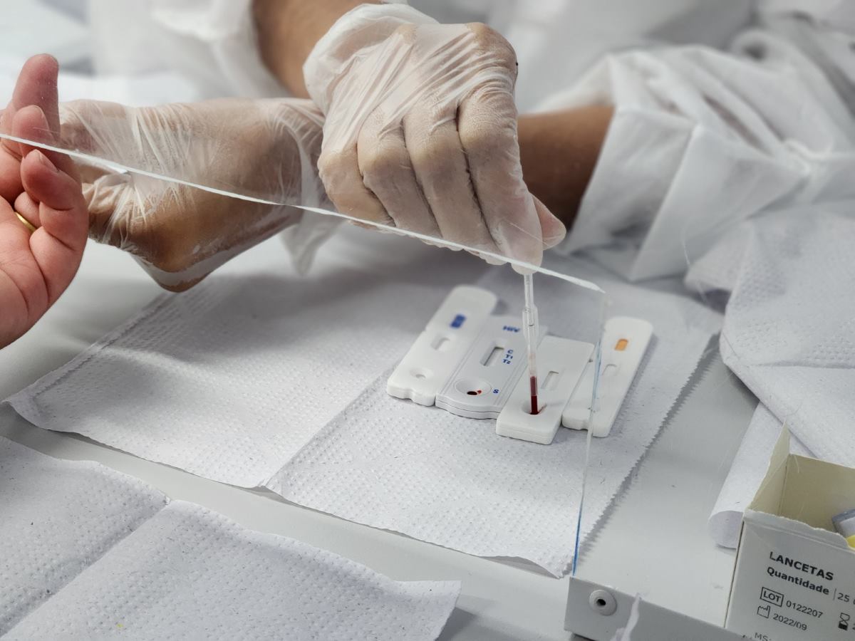 Sesab desmente boato de surto de HIV entre jovens na Bahia