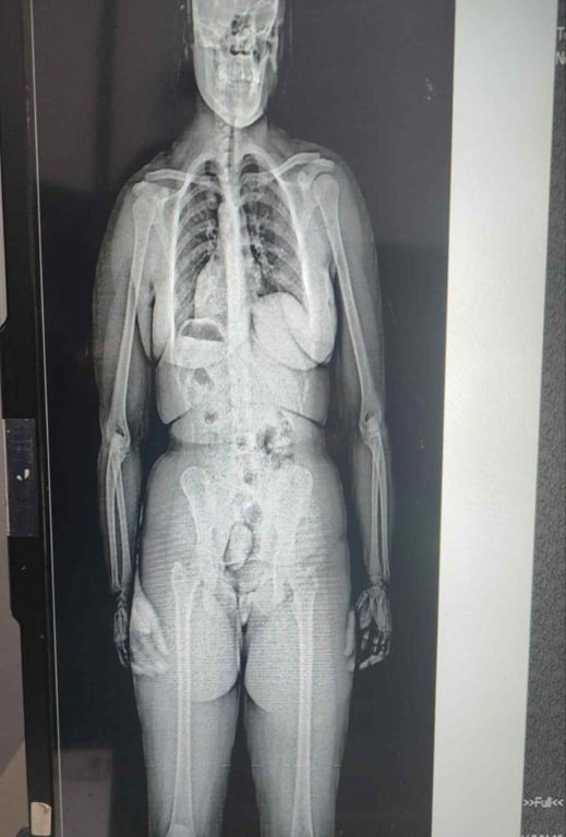 Mulheres são detidas ao tentar entrar com drogas no Conjunto Penal de Eunápolis