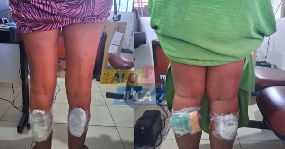 Body scanner: 5 mulheres são flagradas tentando entrar com drogas e álcool na Cadeia Pública de Salvador