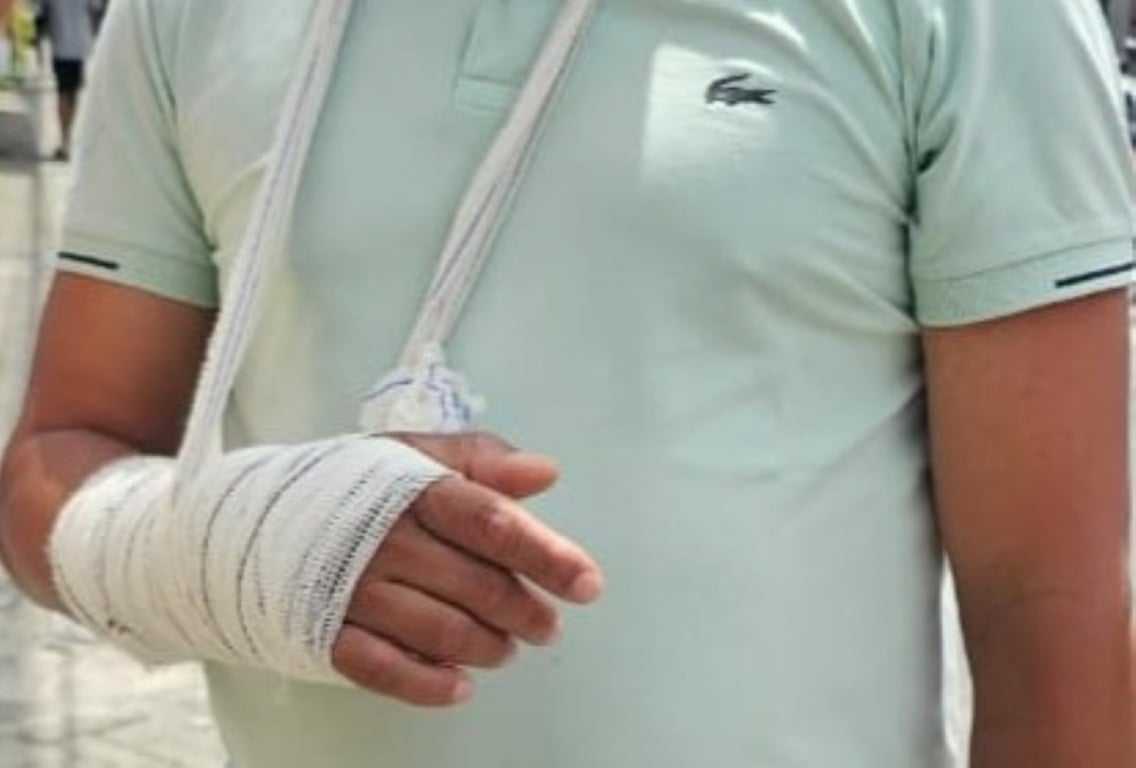 Jurandy Carvalho se recupera de cirurgia no braço 