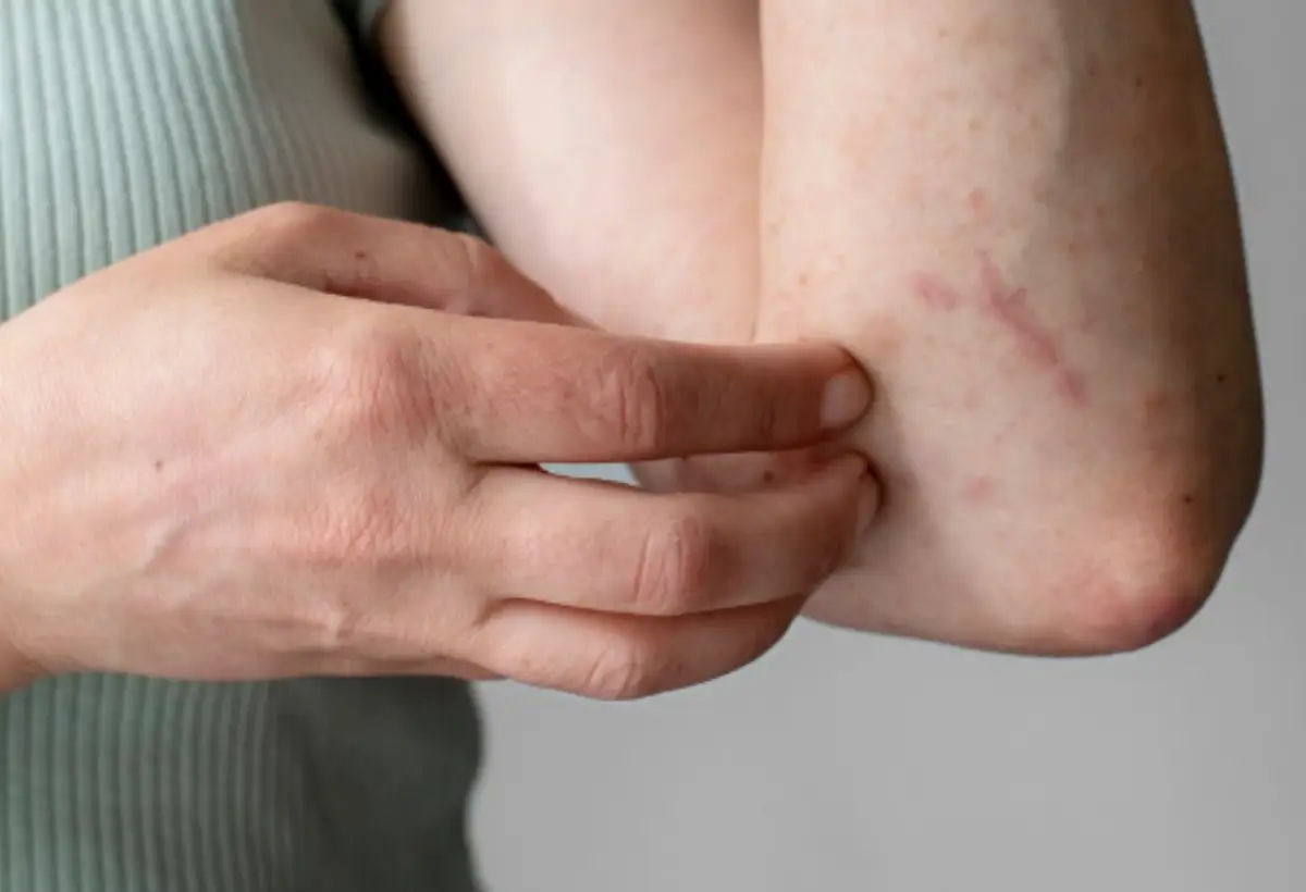 Veterinário alerta para os cuidados com a esporotricose, infecção fúngica comum em gatos, que tem crescido entre os tutores