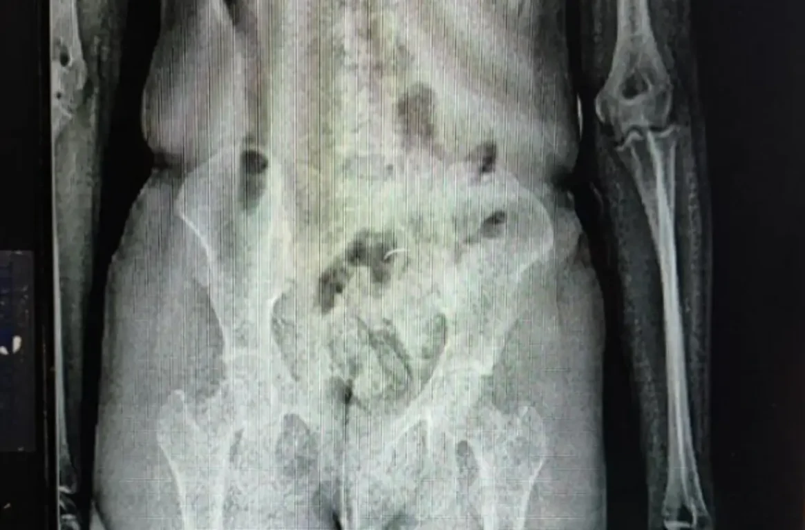 visitante é flagrada com drogas em Conjunto penal de Eunápolis - droga