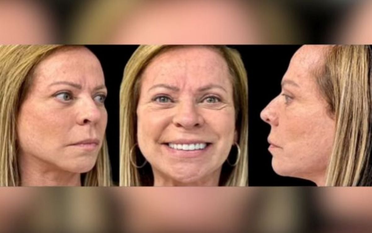 Christina Rocha antes dos procedimentos estéticos