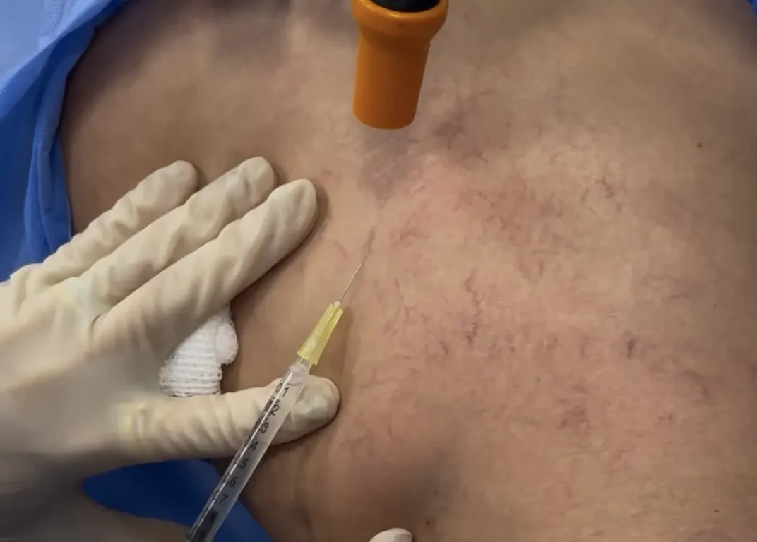 Pernas cansadas não são normais e podem não ter nada a ver com cansaço