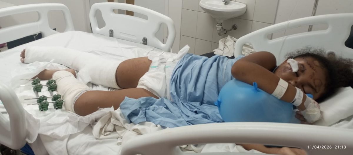 Menina de 8 anos é atropelada por moto em Baixa Grande 1