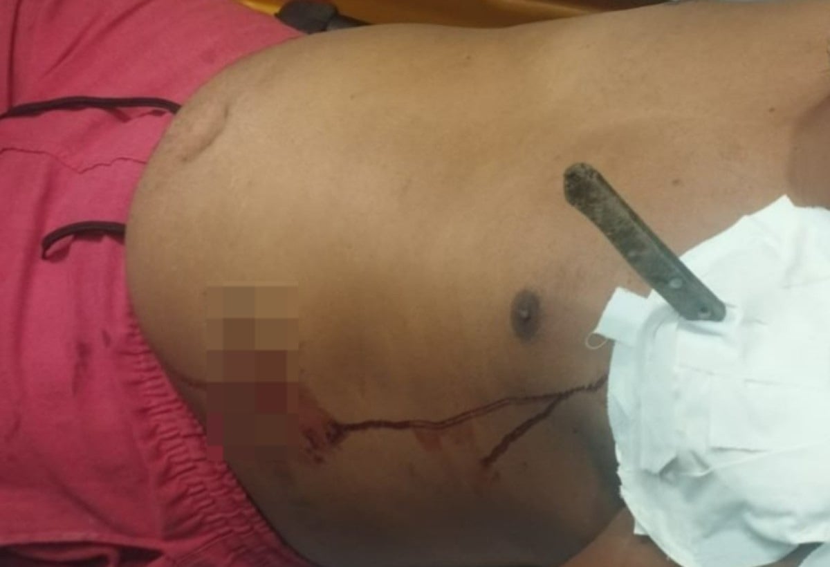 Homem é socorrido com faca cravada no corpo em Gongogi