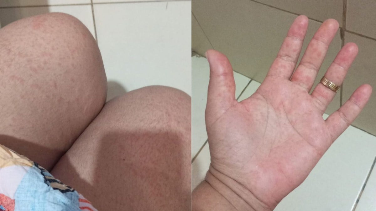moradora com dengue