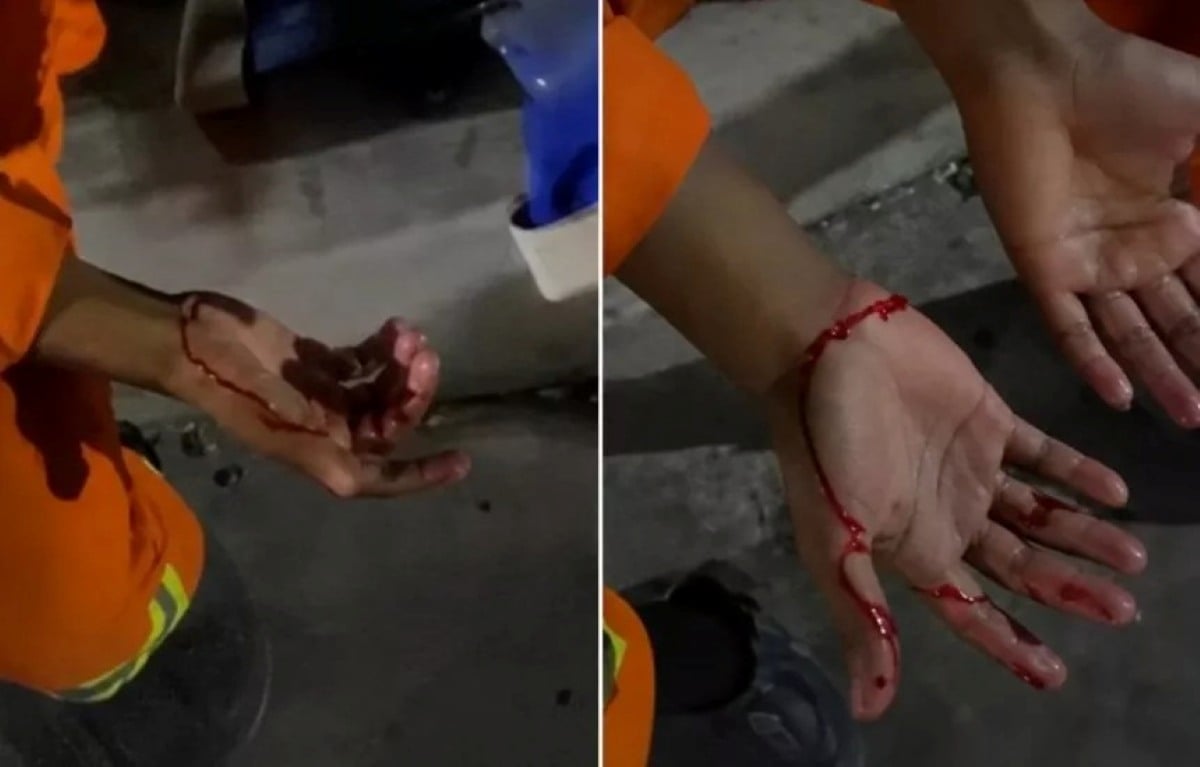 funcionário se corta durante trabalho