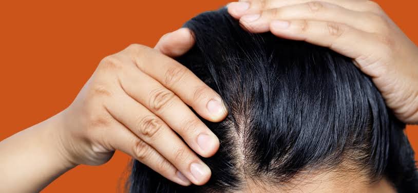 Shampoo para cabelo oleoso: 4 opções para ajudar a controlar a oleosidade