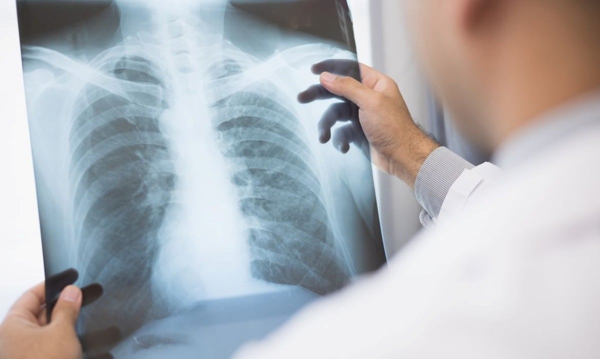 raio x, radiografia