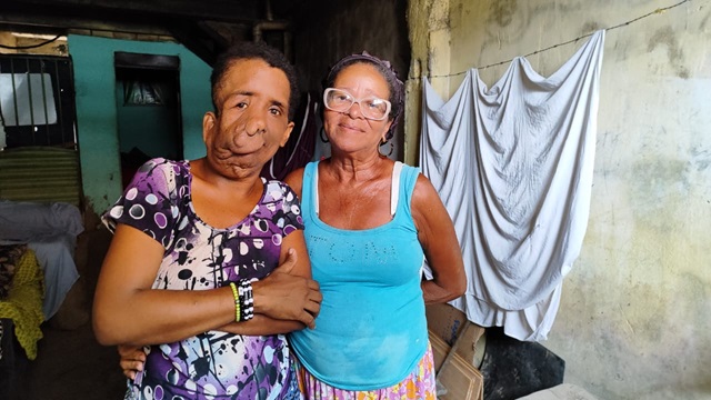 Mae-pede-ajuda-para-comprar-materiais-para-vender-pipoca-apos-filha-sofrer-AVC-ft-ney-silva-acorda-cidade1