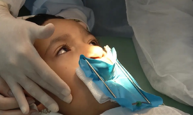 cirugia-de-fissura-labial-labio-leporino-foto-divulgacao-tv-brasil