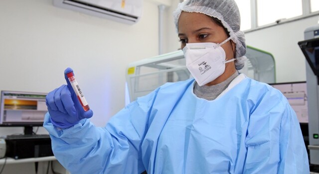 covid-19-exames-variantes-pandemia-foto-Leonardo-Rattes-sesab-640x350-1
