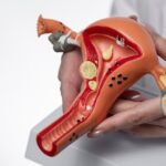 ginecologista-utero-mioma-freepik