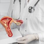 side-view-doctor-holding-anatomic-model-cancer-de-colo-de-utero-saude-janeiro-640x350-1