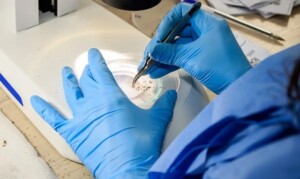 dengue-curso-gratuito-laboratorio-arboviroses-300x179-2