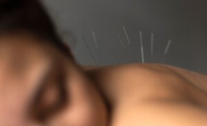 Acupunturista-freepik-300x183-1
