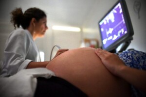 Gravidez-gestantes-gravidas-foto-arquivo-agencia-brasilia-300x200-1