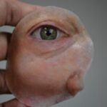 protese-ocular-Foto-Arquivo-Mais-identidade-300x200-1
