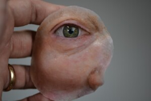 protese-ocular-Foto-Arquivo-Mais-identidade-300x200-1