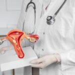 sistema-reprodutivo-feminino-endometriose-Foto-Credito-Freepik-300x200-1