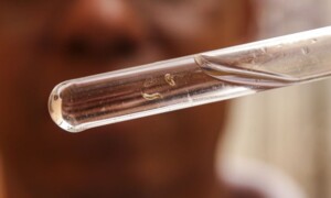 Larvas-Dengue-Foto-Marcelo-Camargo-Agencia-Brasil-300x180-1