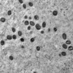 Lfo5DHj3-mpox-jpg-2