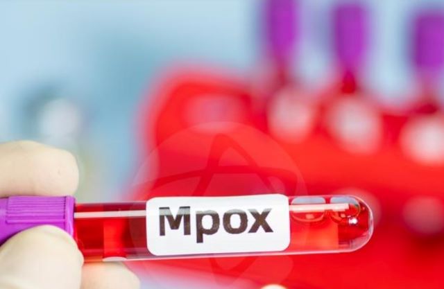 DlZUm88P-casos-mpoz-variola-dos-macacos-virus-foto-agencia-einsten-