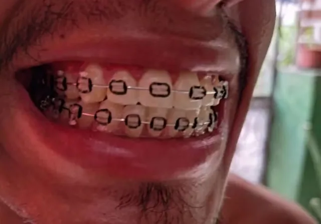 wrNojovN-Falsos-dentistas-em-Salvador-jpg