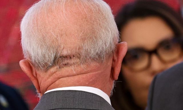 BGEzfIIq-Lula-acidente-cabeca