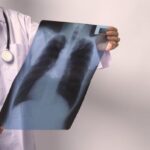 tuberculose-freepik