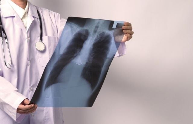 tuberculose-freepik