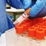 variola-do-macaco-lab_enterovirus_monkeypox_maxgomes-foto-reproducao-sesab