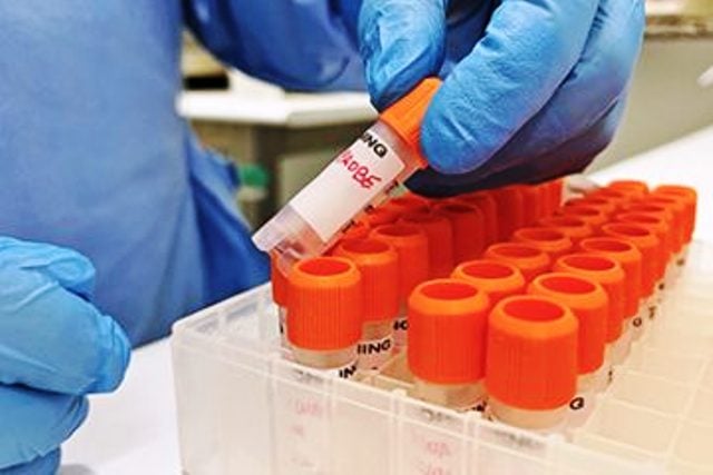 variola-do-macaco-lab_enterovirus_monkeypox_maxgomes-foto-reproducao-sesab