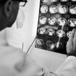 Cancer-cerebral-Exame-tumor-Foto-Freepik