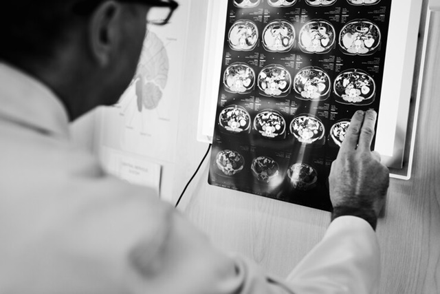 Cancer-cerebral-Exame-tumor-Foto-Freepik