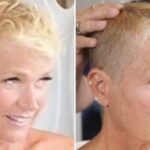 apresentadora-xuxa-alopecia-foto-divulgacao-