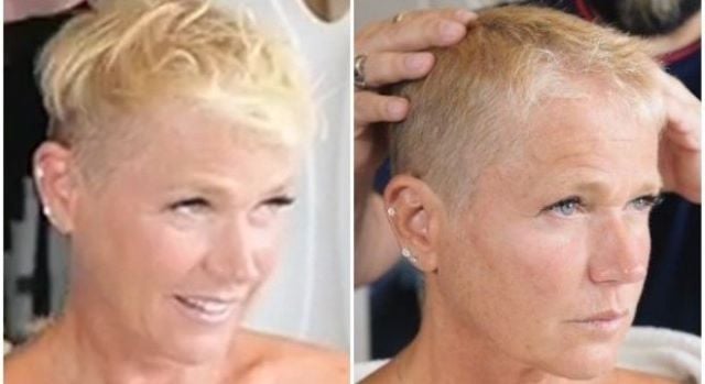 apresentadora-xuxa-alopecia-foto-divulgacao-