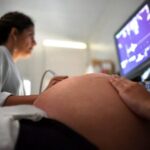 Gravidez-gestantes-gravidas-foto-arquivo-agencia-brasilia