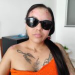 Mulher-vitima-de-ataque-com-acido-busca-ajuda-para-cirurgia-2