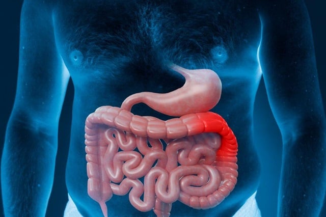 Credito-da-imagem_Freepik_-cancer-colorretal-1