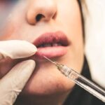 Entenda-por-que-o-uso-do-PMMA-para-fins-esteticos-e-tao-arriscado