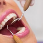 aparelho-dente-dentista-boca-foto-freepik