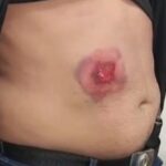 policialcivilbaleado_radarnews