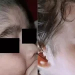 KT35z1iC-bebe-sindrome-do-lobisomem-