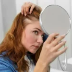 zoDo1GPm-mulher-recebendo-tratamento-para-queda-de-cabelo-em-uma-clinica_23-2149152752
